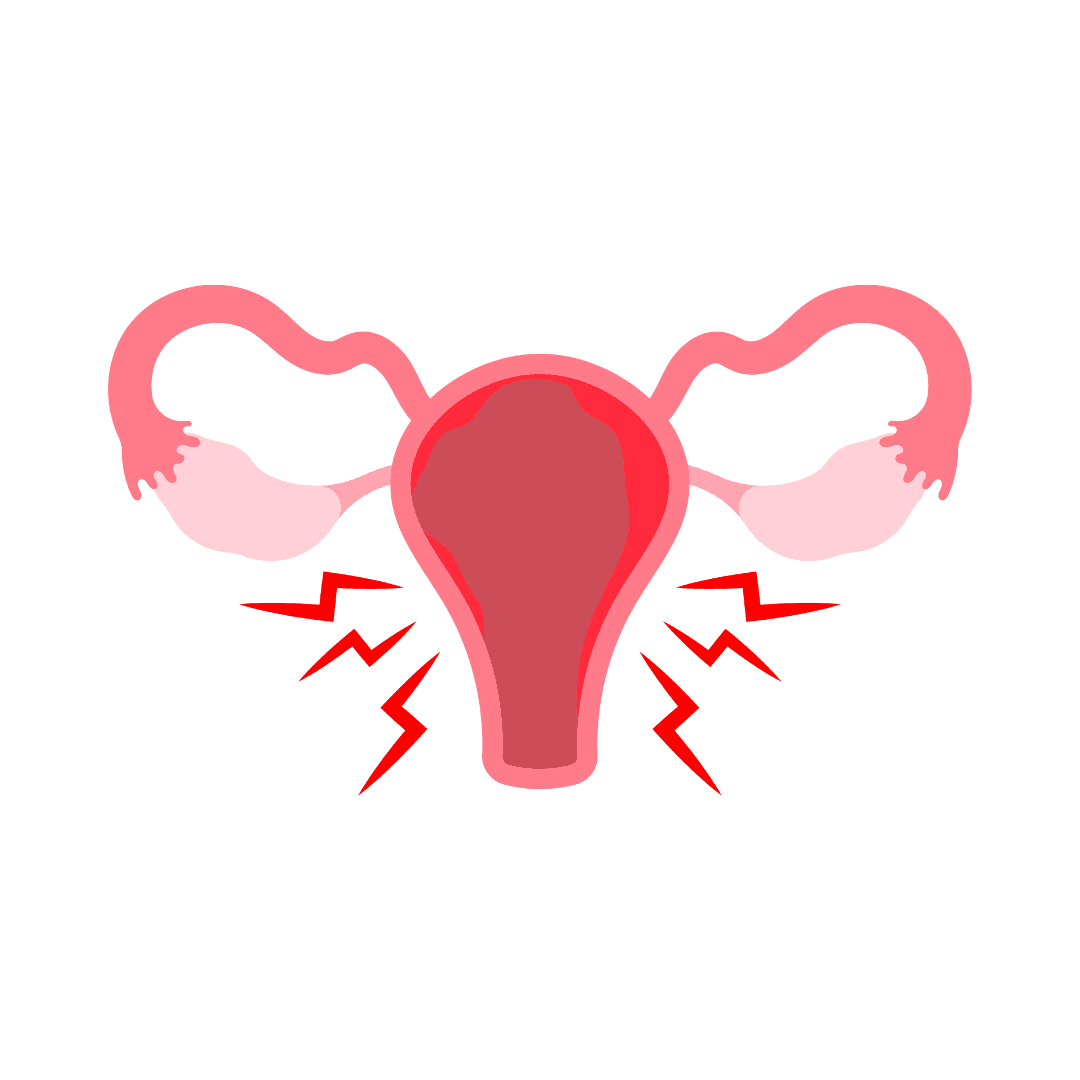 Endometrioza